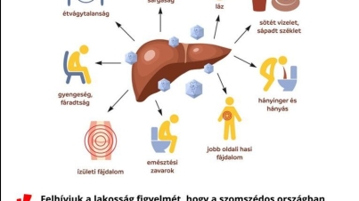 hepatis_a