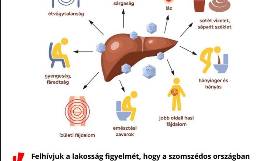 hepatis_a